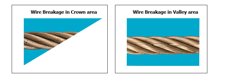 Wire breaks in crown area